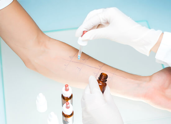 alergija2 Allergologie – Diagnostik und Behandlung